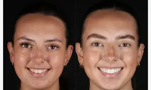 2 0
