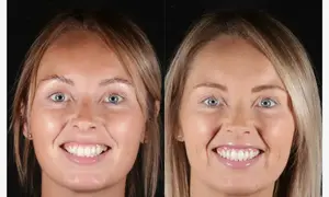 3 1