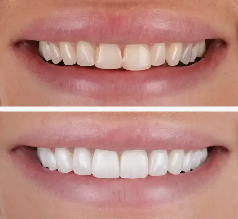 3 1 l